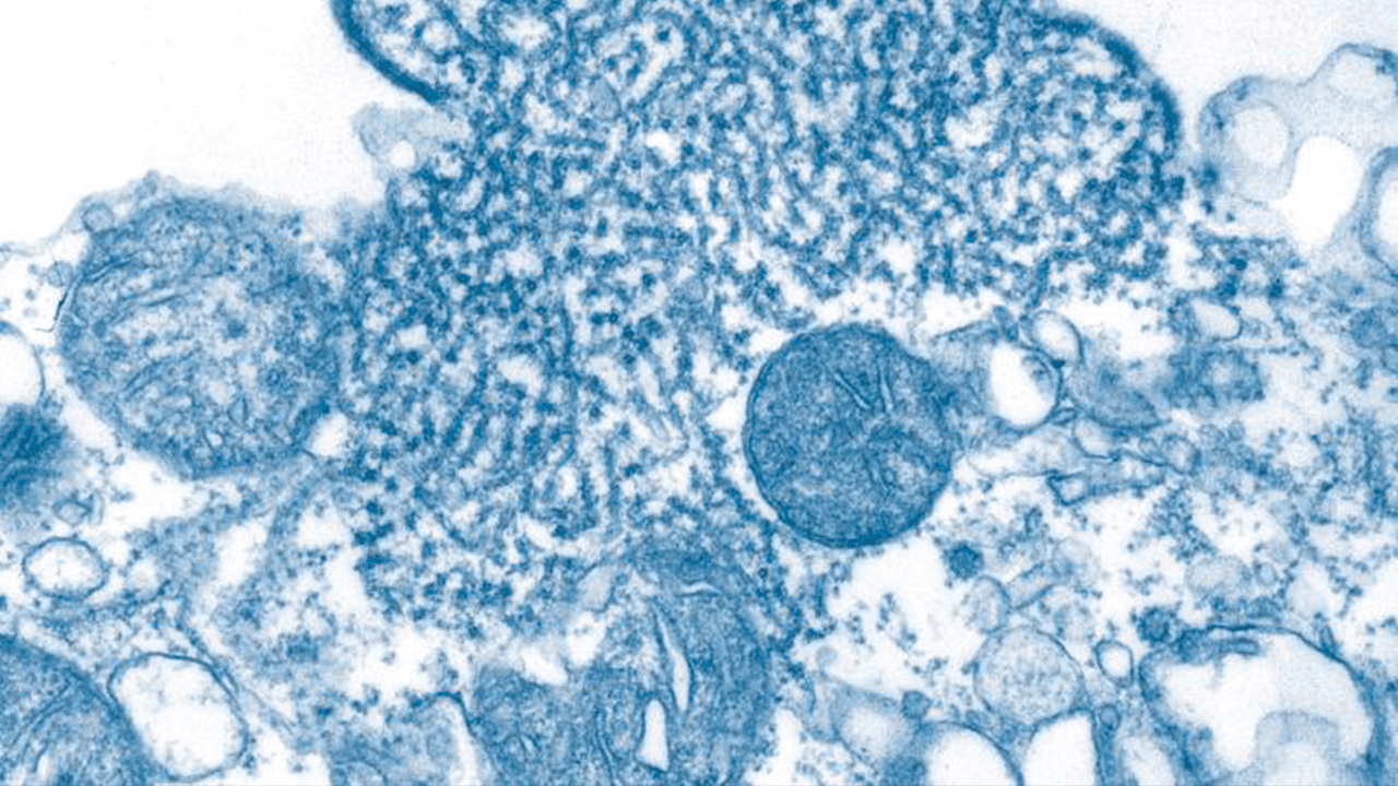 Virus Nipah bajo un microscopio electrónico de transmisión Virus Nipah bajo un microscopio electrónico de transmisión