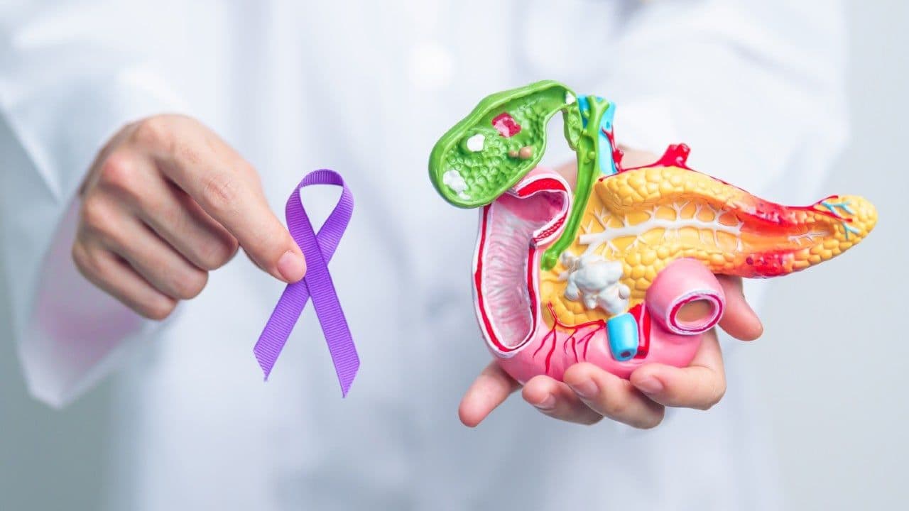 cancer de pancreas foto cancer de pancreas foto