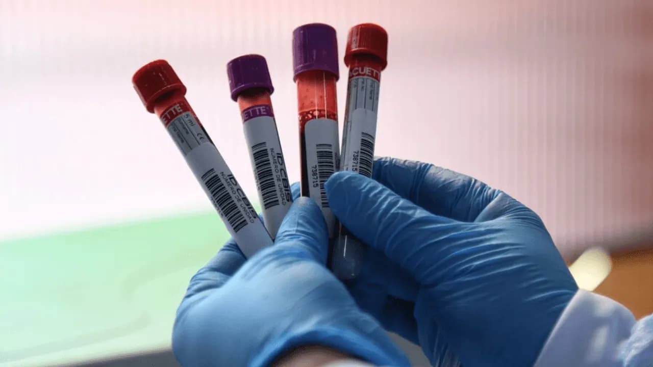 Alerta por reservas críticas de sangre en Colombia: demanda de O+ supera la capacidad de reposición Alerta por reservas críticas de sangre en Colombia: demanda de O+ supera la capacidad de reposición